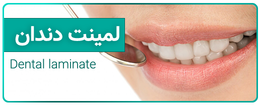 لمینت