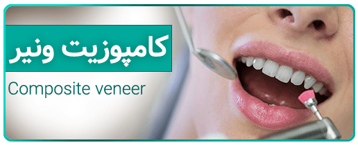 کامپوزیت